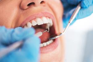 20’lik Diş Ameliyatının Riskleri Nelerdir