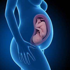 Hidrops Fetalis ile Doğum Nasıl Gerçekleştirilir